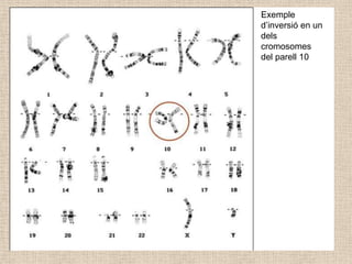 Exemple
d’inversió en un
dels
cromosomes
del parell 10
 