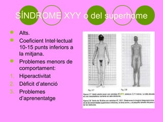 SÍNDROME XYY o del superhome
 Alts.
 Coeficient Intel·lectual
   10-15 punts inferiors a
   la mitjana.
 Problemes menors de
   comportament:
1. Hiperactivitat
2. Dèficit d’atenció
3. Problemes
   d’aprenentatge
 