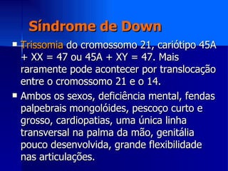 Síndrome de Down <ul><li>Trissomia  do cromossomo 21, cariótipo 45A + XX = 47 ou 45A + XY = 47. Mais raramente pode aconte...