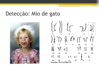 Delecção: Mio de gato