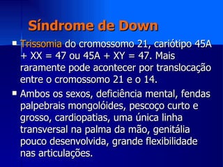 Síndrome de Down Trissomia  do cromossomo 21, cariótipo 45A + XX = 47 ou 45A + XY = 47. Mais raramente pode acontecer por translocação entre o cromossomo 21 e o 14. Ambos os sexos, deficiência mental, fendas palpebrais mongolóides, pescoço curto e grosso, cardiopatias, uma única linha transversal na palma da mão, genitália pouco desenvolvida, grande flexibilidade nas articulações. 
