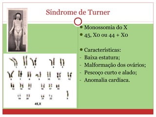 Síndrome de Turner
         Monossomia do X
         45, X0 ou 44 + X0


         Características:
         - Baixa estatura;
         - Malformação dos ovários;
         - Pescoço curto e alado;
         - Anomalia cardíaca.
 