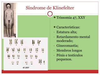 Síndrome de Klinefelter
             Trissomia 47, XXY


             Características:
             - Estatura alta;
             - Retardamento mental
               moderado;
             - Ginecomastia;
             - Membros longos
             - Pênis e testículos
               pequenos.
 