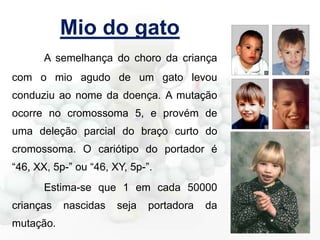 Mio do gato
A semelhança do choro da criança
com o mio agudo de um gato levou
conduziu ao nome da doença. A mutação
ocorre no cromossoma 5, e provém de
uma deleção parcial do braço curto do
cromossoma. O cariótipo do portador é
“46, XX, 5p-” ou “46, XY, 5p-”.
Estima-se que 1 em cada 50000
crianças
mutação.

nascidas

seja

portadora

da

 