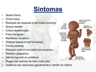 Sintomas
•
•
•
•
•
•
•
•
•
•
•
•
•
•

Atraso físico;
Choro fraco;
Redução da resposta a estímulos sonoros;
Atraso mental;
Crânio desformado;
Face triangular;
Maxilares recuados;
Orelhas baixas e mal formadas;
Fenda palatina;
Pescoço curto e com pelos em excesso;
Mamilos pequenos;
Hérnia inguinal ou umbilical;
Rugas nas palmas da mão e dos pés;
Ausência dos testículos (geralmente) e atrofio do clitóris.

 