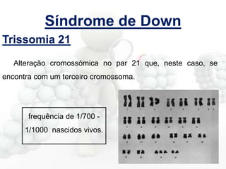 Síndrome de Down
Trissomia 21
Alteração cromossómica no par 21 que, neste caso, se
encontra com um terceiro cromossoma.

frequência de 1/700 -

1/1000 nascidos vivos.

 
