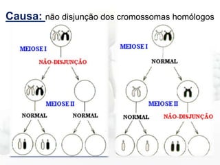 Causa: não disjunção dos cromossomas homólogos

 