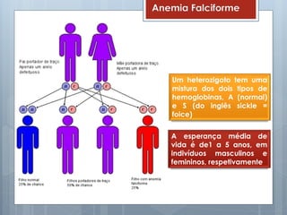 Anemia Falciforme
A esperança média de
vida é de1 a 5 anos, em
indivíduos masculinos e
femininos, respetivamente
Um heterozigoto tem uma
mistura dos dois tipos de
hemoglobinas, A (normal)
e S (do inglês sickle =
foice)
 