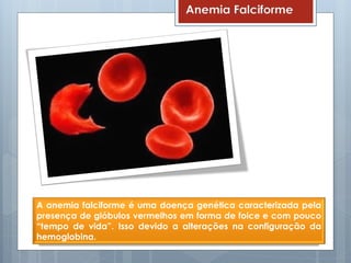 Anemia Falciforme
A anemia falciforme é uma doença genética caracterizada pela
presença de glóbulos vermelhos em forma de foice e com pouco
“tempo de vida”. Isso devido a alterações na configuração da
hemoglobina.
 