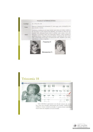 Mutações Cromossómicas