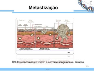 Metastização




Células cancerosas invadem a corrente sanguínea ou linfática
                                                               23
                            IL 2011
 