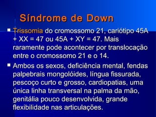 Síndrome de DownSíndrome de Down
 TrissomiaTrissomia do cromossomo 21, cariótipo 45Ado cromossomo 21, cariótipo 45A
+ XX = 47 ou 45A + XY = 47. Mais+ XX = 47 ou 45A + XY = 47. Mais
raramente pode acontecer por translocaçãoraramente pode acontecer por translocação
entre o cromossomo 21 e o 14.entre o cromossomo 21 e o 14.
 Ambos os sexos, deficiência mental, fendasAmbos os sexos, deficiência mental, fendas
palpebrais mongolóides, língua fissurada,palpebrais mongolóides, língua fissurada,
pescoço curto e grosso, cardiopatias, umapescoço curto e grosso, cardiopatias, uma
única linha transversal na palma da mão,única linha transversal na palma da mão,
genitália pouco desenvolvida, grandegenitália pouco desenvolvida, grande
flexibilidade nas articulações.flexibilidade nas articulações.
 