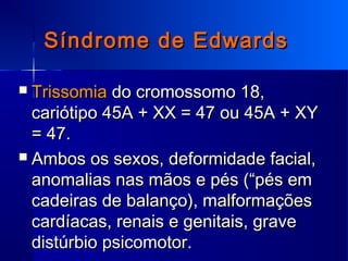 Síndrome de EdwardsSíndrome de Edwards
 TrissomiaTrissomia do cromossomo 18,do cromossomo 18,
cariótipo 45A + XX = 47 ou 45A + XYcariótipo 45A + XX = 47 ou 45A + XY
= 47.= 47.
 Ambos os sexos, deformidade facial,Ambos os sexos, deformidade facial,
anomalias nas mãos e pés (“pés emanomalias nas mãos e pés (“pés em
cadeiras de balanço), malformaçõescadeiras de balanço), malformações
cardíacas, renais e genitais, gravecardíacas, renais e genitais, grave
distúrbio psicomotor.distúrbio psicomotor.
 