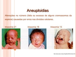 Aneuploidias http://www.assis.unesp.br/egalhard/Numericas.htm Alterações no número (falta ou excesso de alguns cromossomos da espécie) causadas por erros nas divisões celulares. trissomia 21 trissomia 18 trissomia 13 