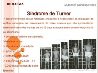 BIOLOGIA Mutações cromossômicas   Síndrome de Turner baixa estatura;  tendência a obesidade; pescoço alado; defeitos cardíacos; ocorrência 1/2.500  - 1 / 10.000 nascimentos do sexo feminino. Desenvolvimento sexual retardado (indicando a necessidade de realização de análise cariotípica em adolescentes de baixa estatura que não apresentarem desenvolvimento das mamas até os 13 anos e apresentarem amenorréia primária ou secundária); geralmente estéreis ou subférteis; http://www.assis.unesp.br/egalhard/Numericas.htm 