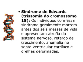 • Síndrome de Edwards
  (trissomia do cromossomo
  18): Os indivíduos com essa
  síndrome geralmente morrem
  antes dos seis messes de vida
  e apresentam atrofia do
  sistema nervoso, retardo de
  crescimento, anomalia no
  septo ventricular cardíaco e
  orelhas deformadas.
 