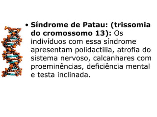 • Síndrome de Patau: (trissomia
  do cromossomo 13): Os
  indivíduos com essa síndrome
  apresentam polidactilia, atrofia do
  sistema nervoso, calcanhares com
  proeminências, deficiência mental
  e testa inclinada.
 