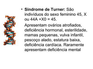 • Sindrome de Turner: São
  indivíduos do sexo feminino 45, X
  ou 44A +X0 = 45.
  Apresentam ovários atrofiados,
  deficiência hormonal, esterilidade,
  mamas pequenas, vulva infantil,
  pescoço alado, estatura baixa,
  deficiência cardíaca. Raramente
  apresentam deficiência mental
 