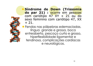 Síndrome de Down (Trissomia
do par 21) : ocorre em pessoas
com cariótipo 47 XY + 21 ou do
sexo feminino com cariótipo 47, XX
+ 21.
Fendas nas pálpebras edemaciadas,
    língua grande e grossa, boca
entreaberta, pescoço curto e grosso,
    hiperflexibilidade ligamentar e
 tendinosa, complicações cardíacas
            e neurológicas.




                              13
 