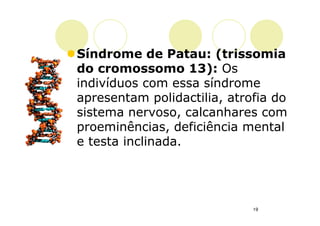 Síndrome de Patau: (trissomia
do cromossomo 13): Os
indivíduos com essa síndrome
apresentam polidactilia, atrofia do
sistema nervoso, calcanhares com
proeminências, deficiência mental
e testa inclinada.




                             19
 