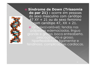 Síndrome de Down (Trissomia
  do par 21) : ocorre em pessoas
  do sexo masculino com cariótipo
  47 XY + 21 ou do sexo feminino
     com cariótipo 47, XX + 21.
    QI baixo(variável); fendas nas
   pálpebras edemaciadas, língua
grande e grossa, boca entreaberta,
       pescoço curto e grosso,
    hiperflexibilidade ligamentar e
tendinosa, complicações cardíacas.




                              14
 