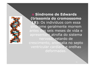 Síndrome de Edwards
 (trissomia do cromossomo
  18): Os indivíduos com essa
 síndrome geralmente morrem
antes dos seis meses de vida e
 apresentam atrofia do sistema
      nervoso, retardo de
crescimento, anomalia no septo
 ventricular cardíaco e orelhas
          deformadas.


                          18
 