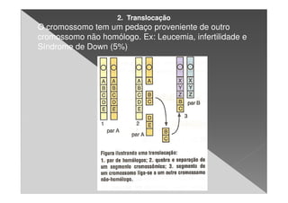 2. Translocação
O cromossomo tem um pedaço proveniente de outro
cromossomo não homólogo. Ex: Leucemia, infertilidade e
Síndrome de Down (5%)
 