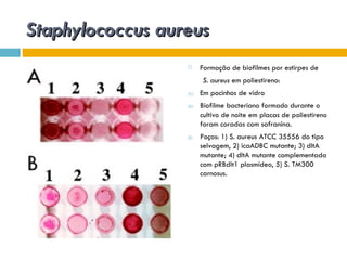 Staphylococcus aureus
                       Formação de biofilmes por estirpes de
                        S. aureus em poliestireno:
                  (C)   Em pocinhos de vidro
                  (D)   Biofilme bacteriano formado durante o
                        cultivo de noite em placas de poliestireno
                        foram coradas com safranina.
                  (E)   Poços: 1) S. aureus ATCC 35556 do tipo
                        selvagem, 2) icaADBC mutante; 3) dltA
                        mutante; 4) dltA mutante complementada
                        com pRBdlt1 plasmídeo, 5) S. TM300
                        carnosus.
 