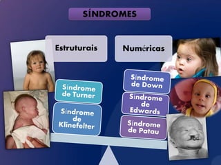 SÍNDROMES


Estruturais   Numéricas
 