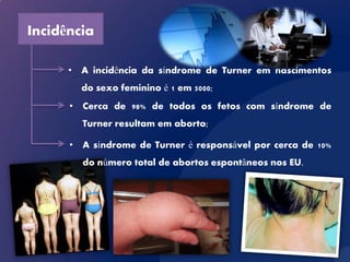 Incidência

      • A incidência da síndrome de Turner em nascimentos
        do sexo feminino é 1 em 5000;
      • Cerca de 98% de todos os fetos com síndrome de
        Turner resultam em aborto;

      • A síndrome de Turner é responsável por cerca de 10%
        do número total de abortos espontâneos nos EU.
 