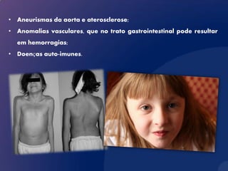 • Aneurismas da aorta e aterosclerose;
• Anomalias vasculares, que no trato gastrointestinal pode resultar
  em hemorragias;
• Doenças auto-imunes.
 