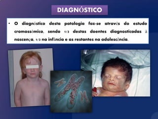 DIAGNÓSTICO
• O diagnóstico desta patologia faz-se através do estudo
  cromossómico, sendo 1/3 destas doentes diagnosticadas à
  nascença, 1/3 na infância e as restantes na adolescência.
 