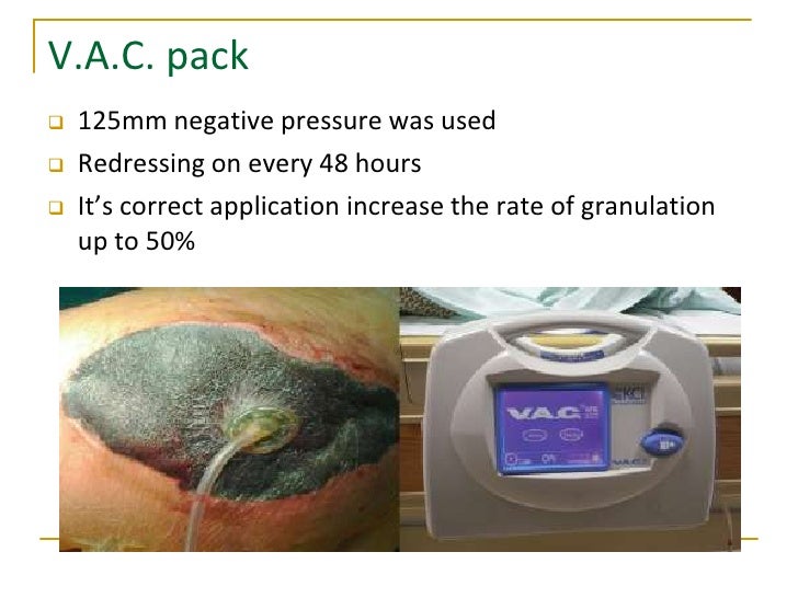Severe secondary blast injuries contemporary surgical approaches