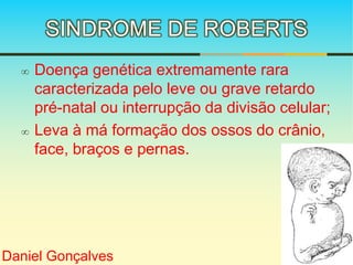 SINDROME DE ROBERTS 
 Doença genética extremamente rara 
caracterizada pelo leve ou grave retardo 
pré-natal ou interrupção da divisão celular; 
 Leva à má formação dos ossos do crânio, 
face, braços e pernas. 
Daniel Gonçalves 
 