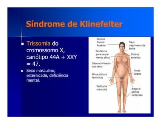 Síndrome deSíndrome de KlinefelterKlinefelter
TrissomiaTrissomia dodo
cromossomo X,cromossomo X,
cariótipo 44A + XXYcariótipo 44A + XXY
= 47.= 47.= 47.= 47.
Sexo masculino,Sexo masculino,
esterilidade, deficiênciaesterilidade, deficiência
mental.mental.
 