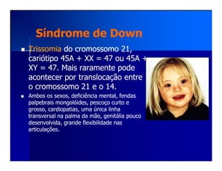 Síndrome deSíndrome de DownDown
TrissomiaTrissomia do cromossomo 21,do cromossomo 21,
cariótipo 45A + XX = 47 ou 45A +cariótipo 45A + XX = 47 ou 45A +
XY = 47. Mais raramente podeXY = 47. Mais raramente pode
acontecer poracontecer por translocaçãotranslocação entreentre
o cromossomo 21 e o 14.o cromossomo 21 e o 14.o cromossomo 21 e o 14.o cromossomo 21 e o 14.
Ambos os sexos, deficiência mental, fendasAmbos os sexos, deficiência mental, fendas
palpebrais mongolóides, pescoço curto epalpebrais mongolóides, pescoço curto e
grosso, cardiopatias, uma única linhagrosso, cardiopatias, uma única linha
transversal na palma da mão, genitália poucotransversal na palma da mão, genitália pouco
desenvolvida, grande flexibilidade nasdesenvolvida, grande flexibilidade nas
articulações.articulações.
 