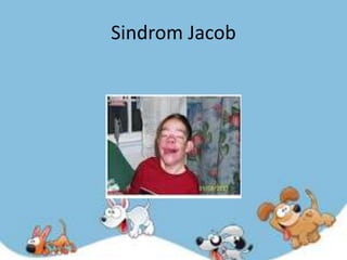 Sindrom Jacob
 