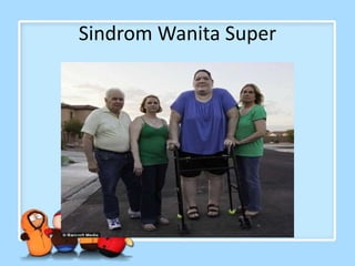 Sindrom Wanita Super
 