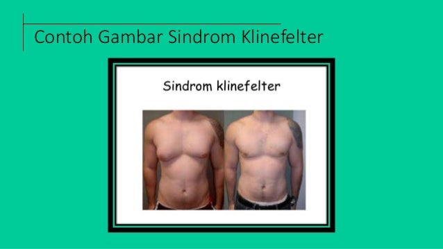 Powerpoint Mutasi dalam mekanisme evolusi manusia biologi SMA