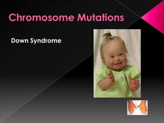 Down Syndrome