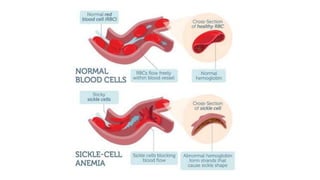 MUTATION.pptx learn different ways of mutation how does it happen