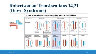 Robertsonian Translocations 14,21
(Down Syndrome)
October 2018 23
 