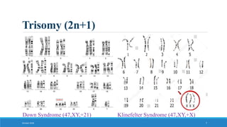 Trisomy (2n+1)
October 2018 7
Down Syndrome (47,XY,+21) Klinefelter Syndrome (47,XY,+X)
 