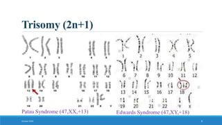 Trisomy (2n+1)
October 2018 8
Patau Syndrome (47,XX,+13) Edwards Syndrome (47,XY,+18)
 