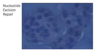 Nucleotide
Excision
Repair
 