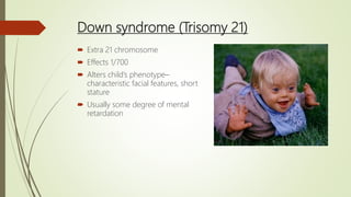Down syndrome (Trisomy 21)
 Extra 21 chromosome
 Effects 1/700
 Alters child’s phenotype–
characteristic facial features, short
stature
 Usually some degree of mental
retardation
 
