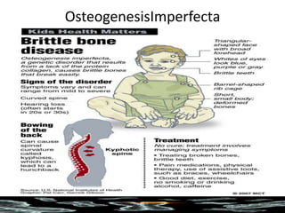 OsteogenesisImperfecta
 