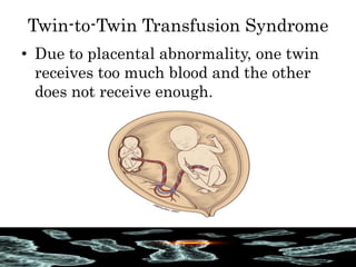 Twin-to-Twin Transfusion Syndrome
• Due to placental abnormality, one twin
receives too much blood and the other
does not receive enough.
 