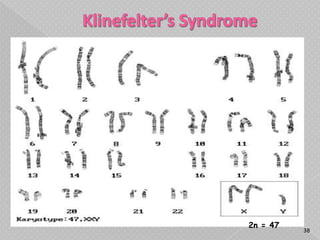 2n = 47
          38
 