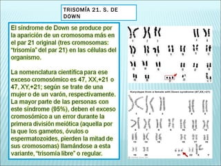TRISOMÍA 21. S. DE DOWN 